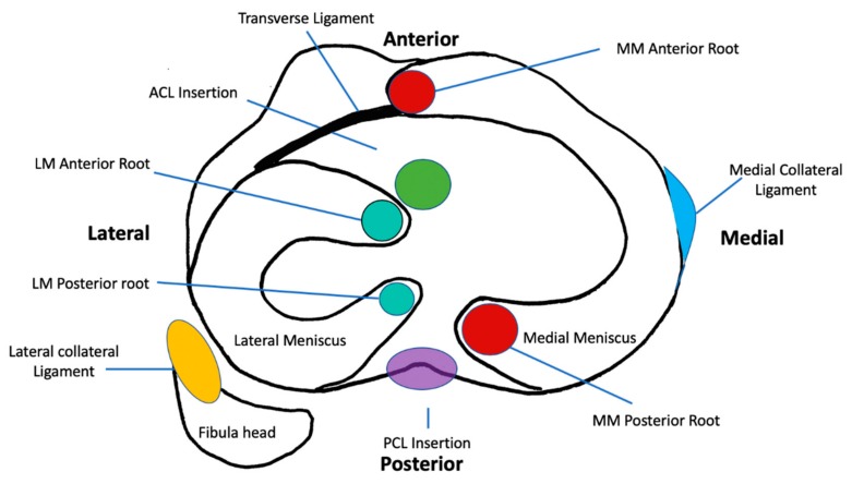 圖1：脛骨平臺水平的軸向截面示意圖，描繪了半月板的解剖結構、附件和關(guān)系