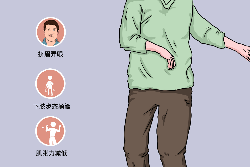 干細胞療法治療亨廷頓病的臨床前試驗進(jìn)展 干細胞療法治療亨廷頓病的臨床前試驗進(jìn)展