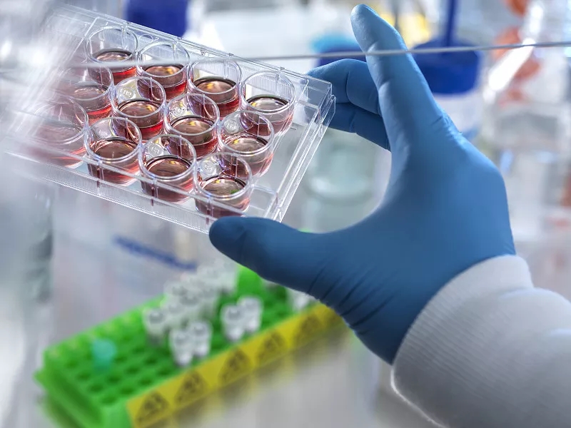 間充質(zhì)干細胞治療阿爾茨海默病的臨床前研究