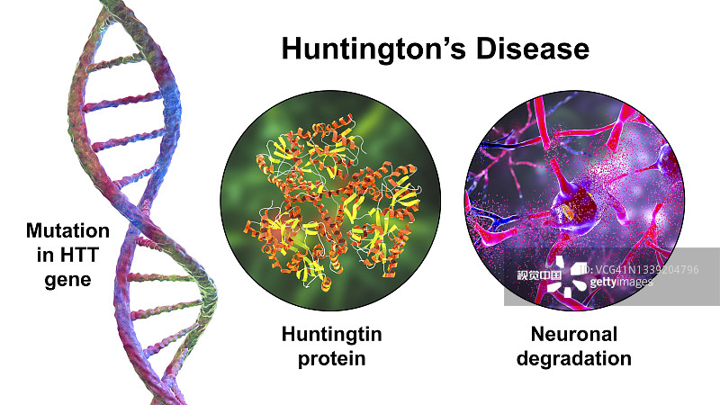 亨廷頓氏病，概念性說(shuō)明