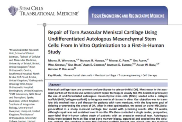 間充質(zhì)干細胞能夠幫助修復受損的半月板組織，不用手術(shù)切除受傷部位也能讓膝關(guān)節功能恢復正常。