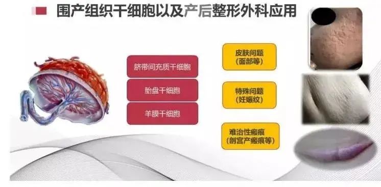 圍產(chǎn)組織細胞以及產(chǎn)后整形外科應用