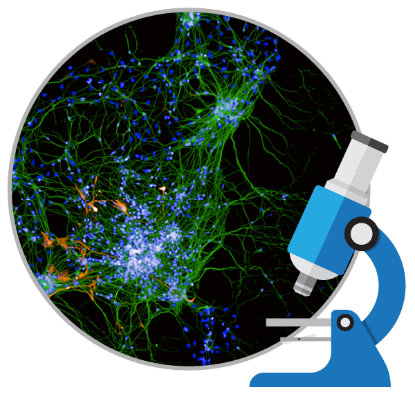 干細胞能治療好阿爾茨海默癥嗎？