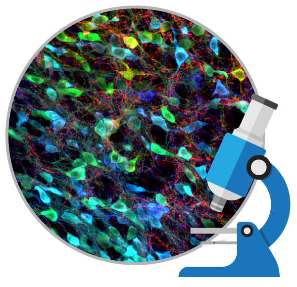 盤(pán)點(diǎn):干細胞移植治療帕金森病的臨床研究進(jìn)展