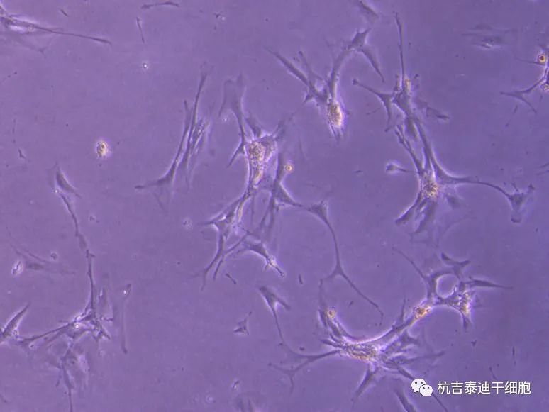 可能的腎臟干細胞，在實(shí)驗室中生長(cháng)