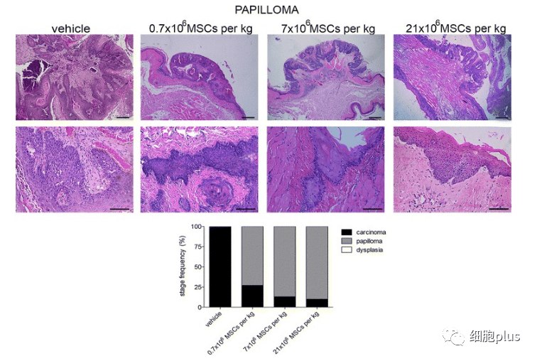 在非典型增生期，全身注射同種異體間充質(zhì)干細胞不會(huì )增加腫瘤的惡性程度。