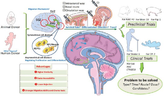 神經(jīng)干細胞移植治療中風(fēng)的臨床試驗的步驟和挑戰 神經(jīng)干細胞移植治療中風(fēng)的臨床試驗的步驟和挑戰