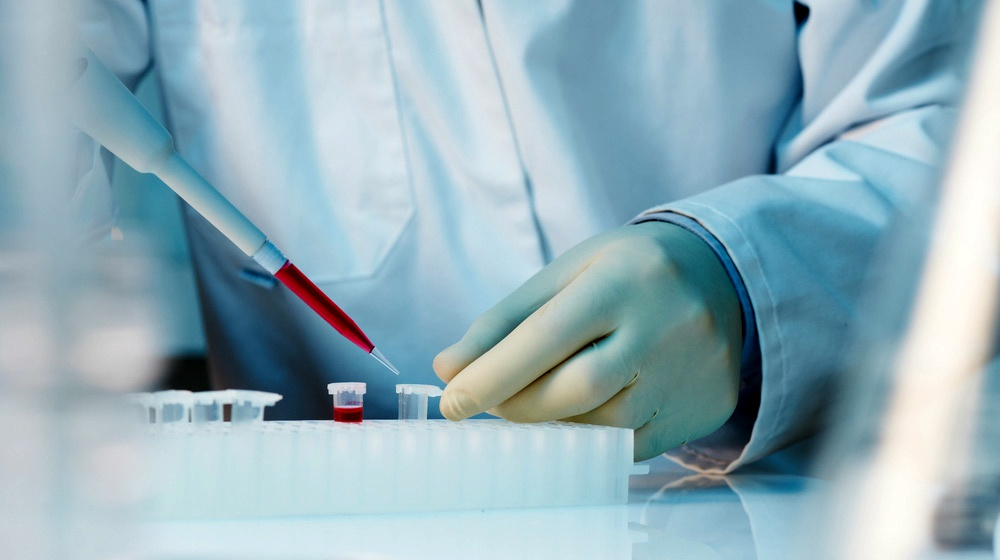 什么是干細胞移植-干細胞移植的流程和優(yōu)勢