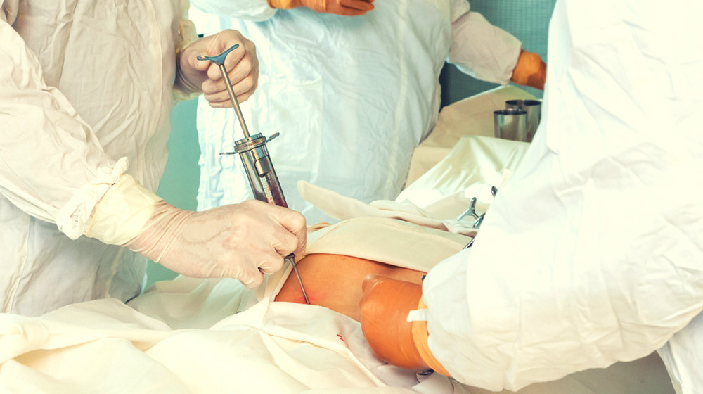 關(guān)于自體干細胞移植的須知 關(guān)于自體干細胞移植的須知