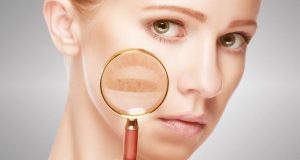 間充質(zhì)干細胞治療系統性紅斑狼瘡 間充質(zhì)干細胞治療系統性紅斑狼瘡