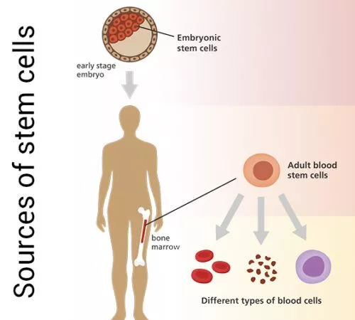 干細胞的來(lái)源是什么