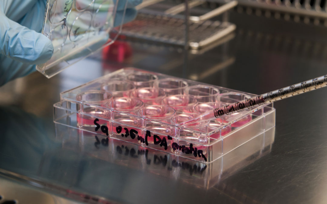 踝關(guān)節疼痛的干細胞療法