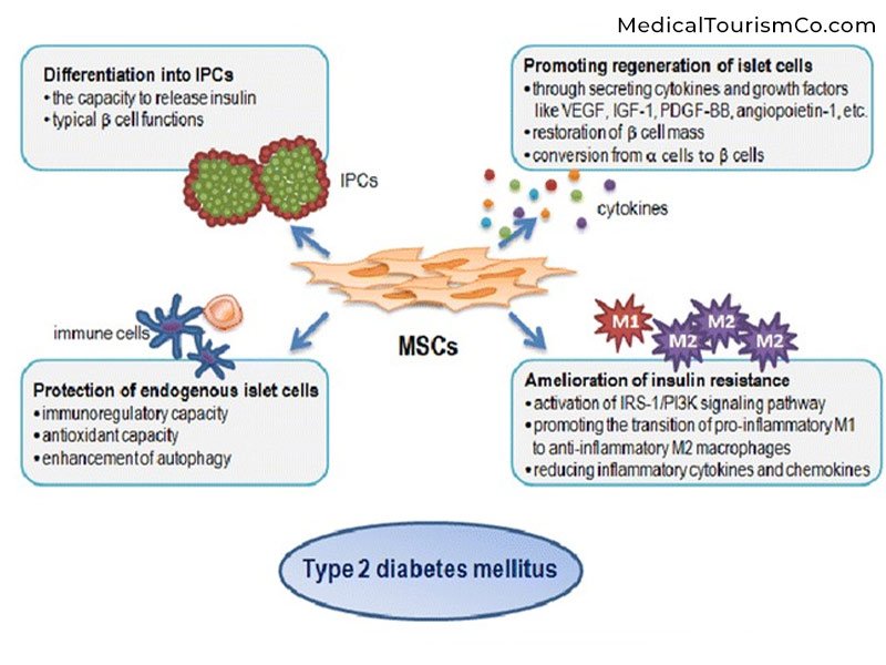 為什么干細胞治療2型糖尿??？