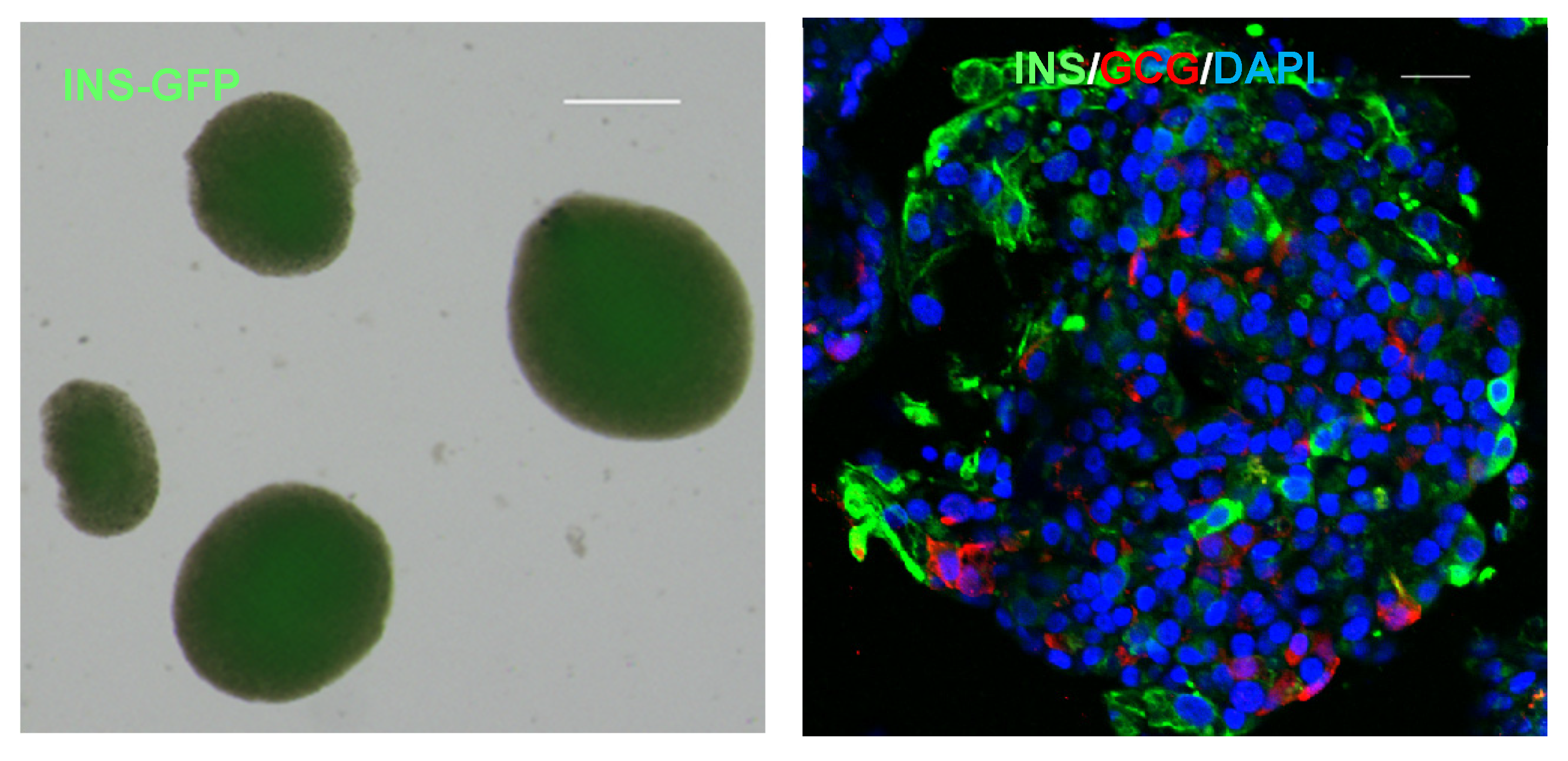 圖1顯示了人類(lèi)多能干細胞 (hPSC) 衍生的胰島器官的圖像