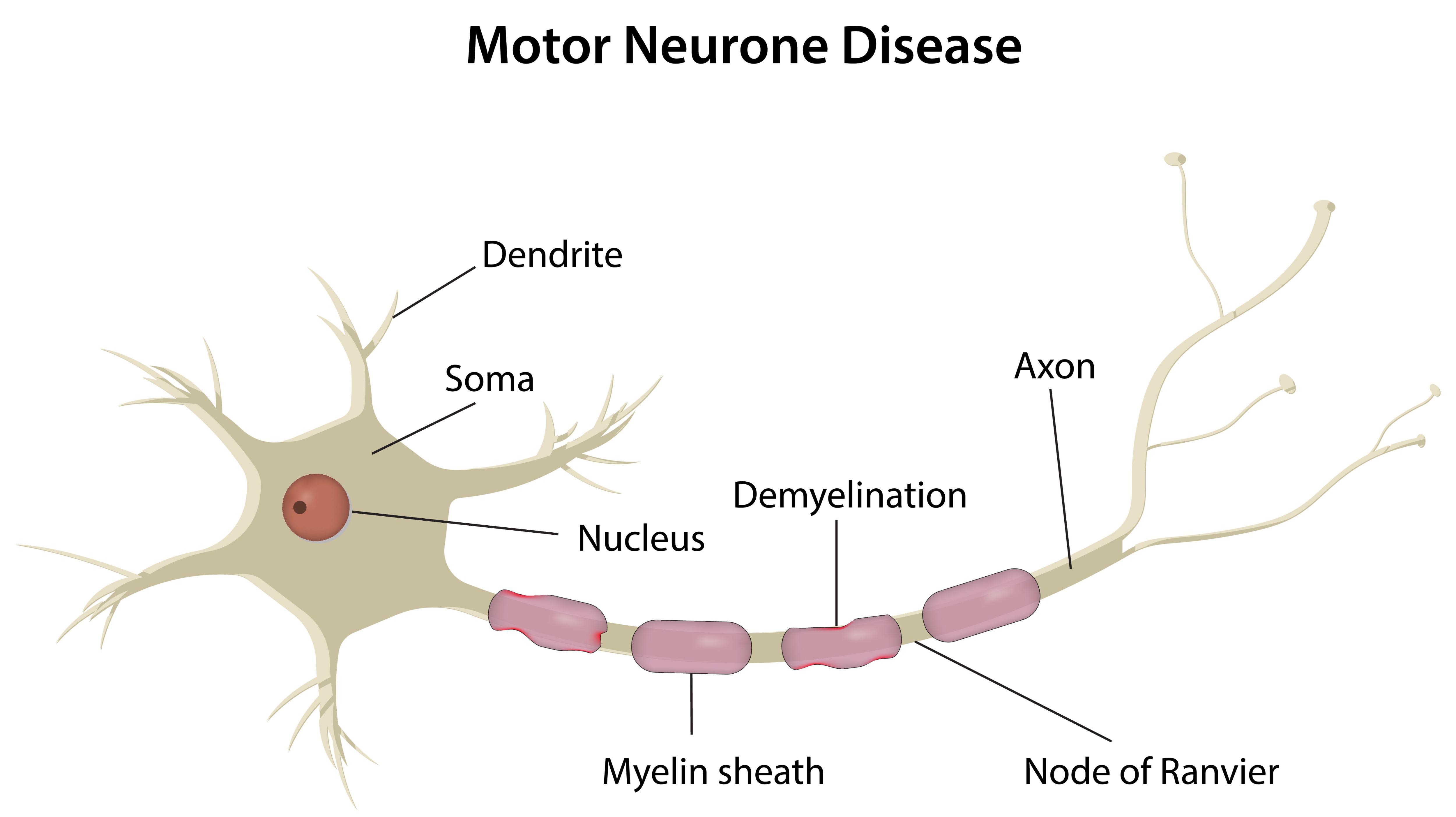 什么是運動(dòng)神經(jīng)元??？