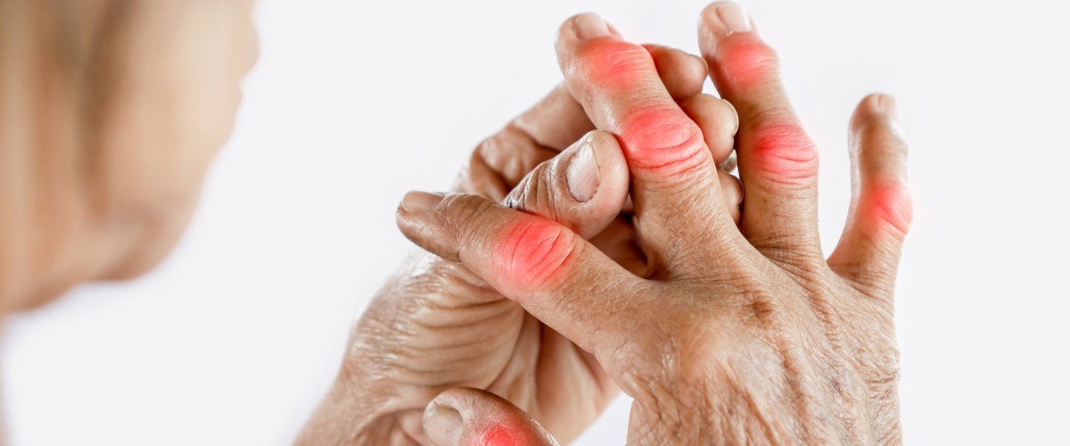 間充質(zhì)干細胞治療全身性風(fēng)濕病的臨床研究進(jìn)展