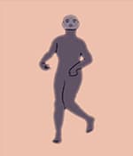 運動(dòng)障礙型腦癱涉及過(guò)度的不自主運動(dòng)。
運動(dòng)障礙性腦癱的類(lèi)型
肌張力障礙：僵硬和松弛交替出現，
舞蹈徐徐樣腦癱：持續的不自主運動(dòng)導致姿勢異常。