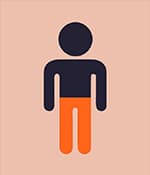 雙側腦癱，影響雙腿或雙臂。