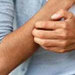 肝臟損傷的警告信號，肝臟疾病的警告信號 - 瘙癢