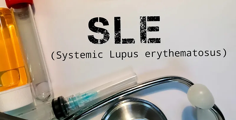 南京鼓樓醫院:干細胞治療在系統性紅斑狼瘡中維持長(cháng)期治療效果 南京鼓樓醫院:干細胞治療在系統性紅斑狼瘡中維持長(cháng)期治療效果