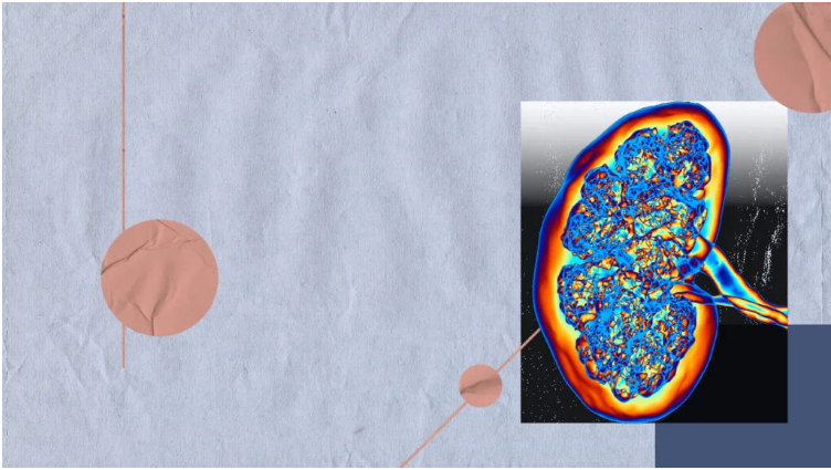 如何篩查糖尿病腎病-有哪些方法？