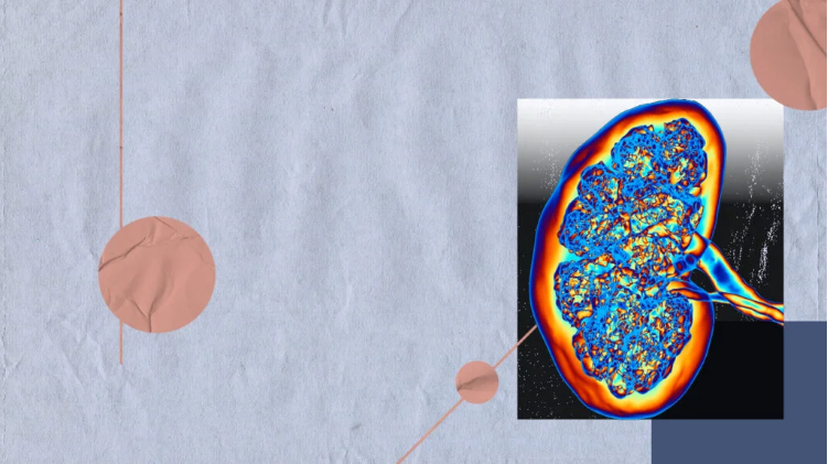 急性腎損傷與腎衰竭：它們有何不同？