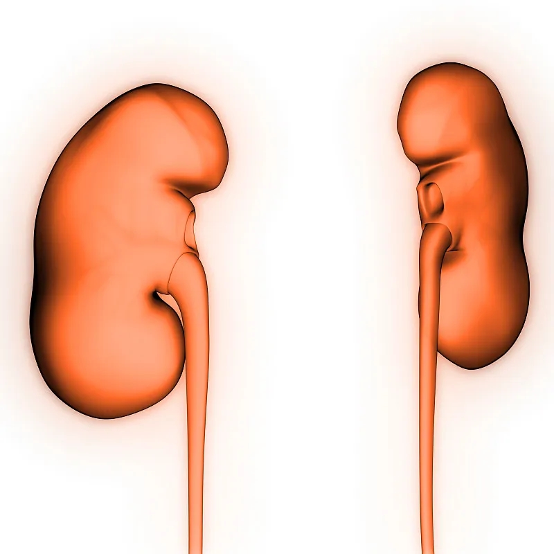 IgA腎?。喊Y狀-病因-診斷-飲食等