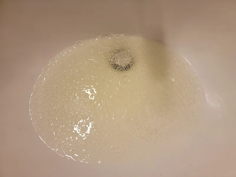 免疫球蛋白和免疫球蛋白血液化驗:功能和目的 免疫球蛋白和免疫球蛋白血液化驗:功能和目的