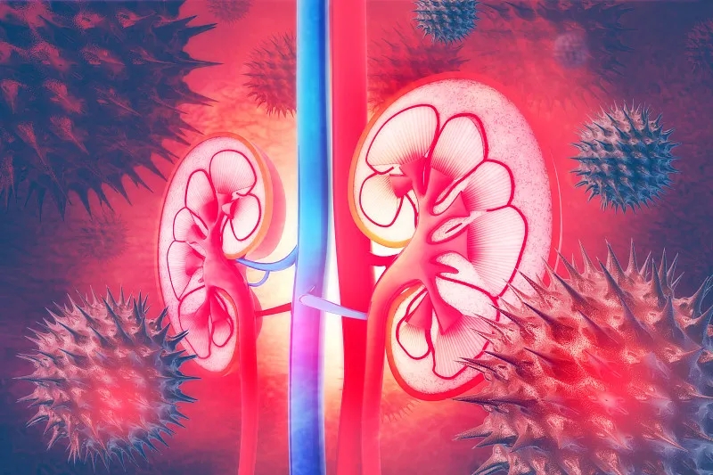 常見(jiàn)問(wèn)題解答：IgA腎病的進(jìn)展