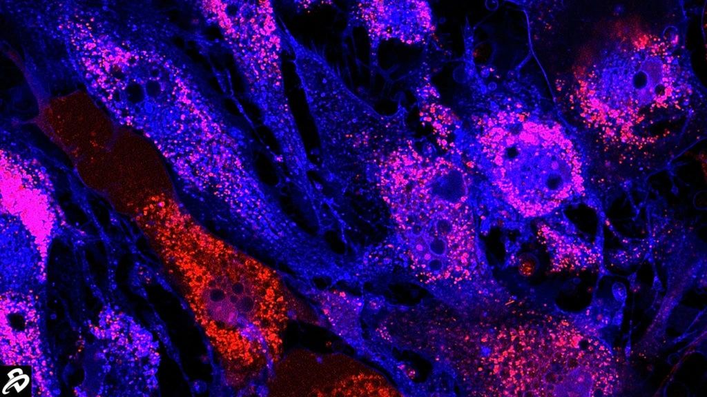 干細胞治療：未來(lái)醫學(xué)的新星，2030年獲批數量或將突破25款