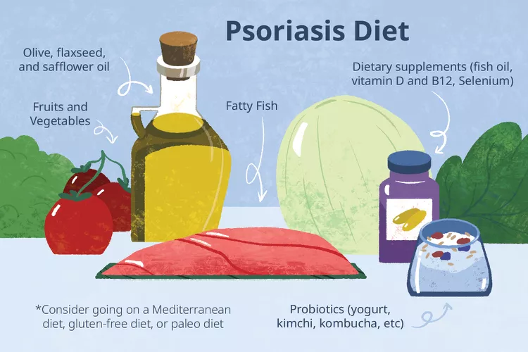適合銀屑病患者吃的5種食物，你知道幾種？