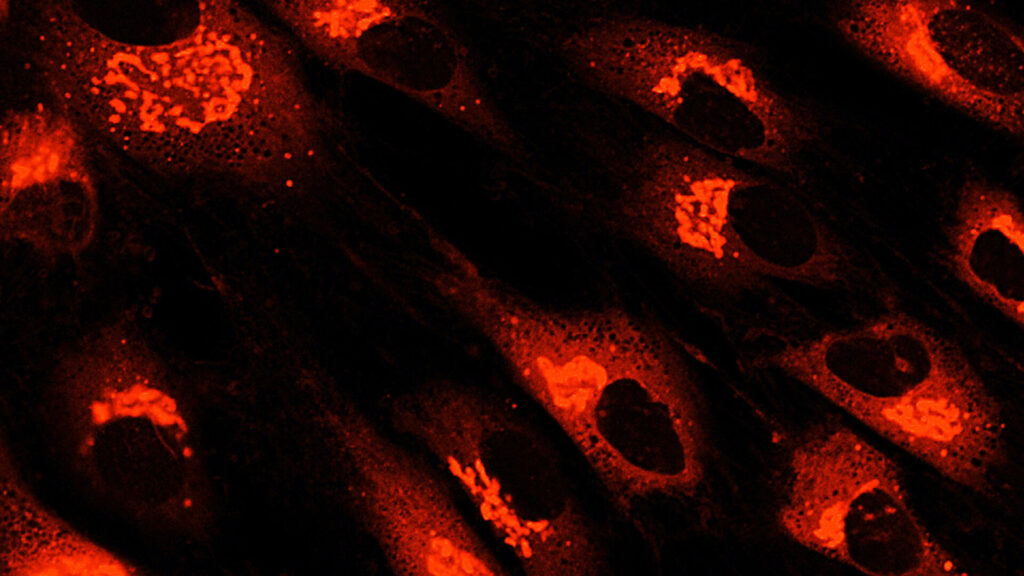 間充質(zhì)干細胞衍生療法和外泌體作為先進(jìn)療法的后起之秀