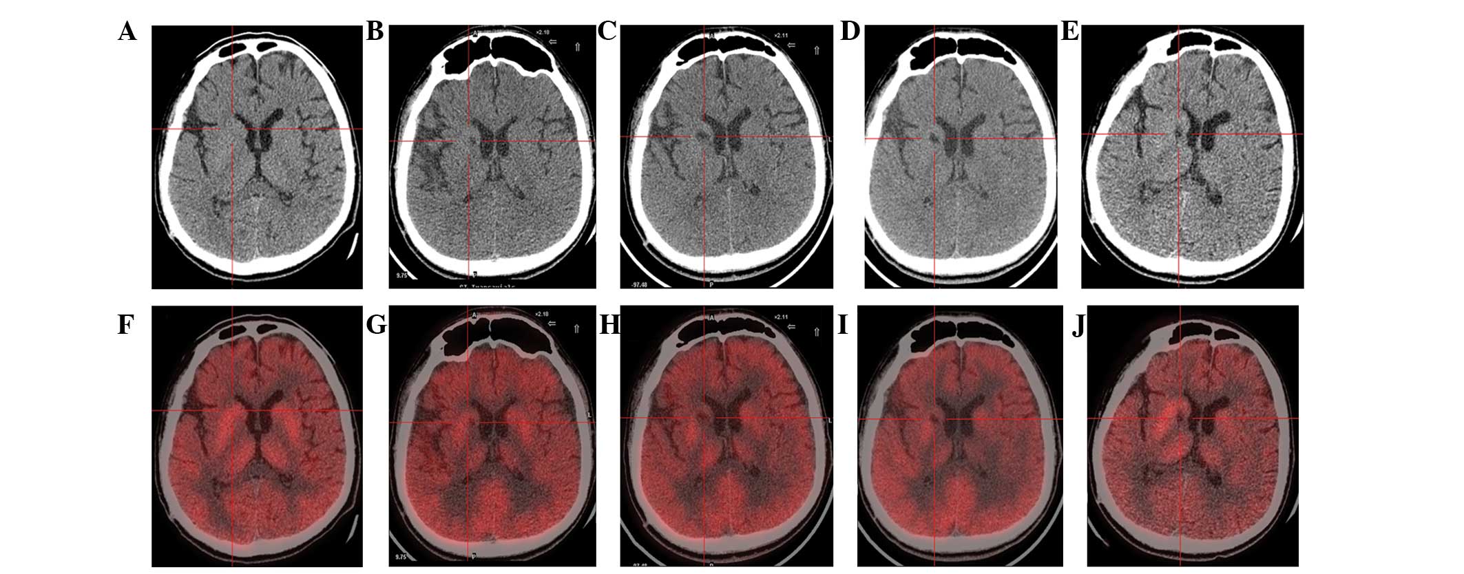 圖1：計算機斷層掃描 (CT) 和正電子發(fā)射斷層掃描 (PET) 掃描。