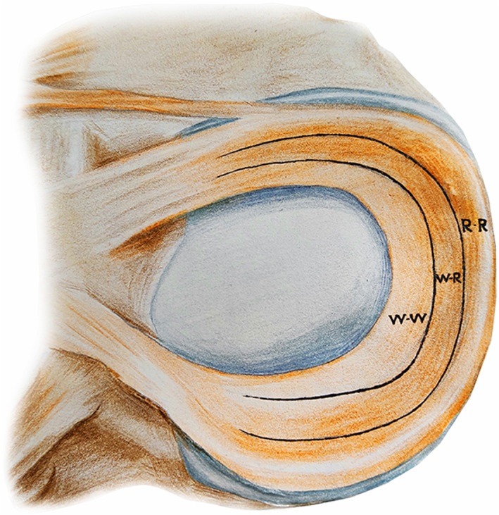圖1：根據報告的血管分布，半月板的插圖展示了經(jīng)典的三個(gè)區域