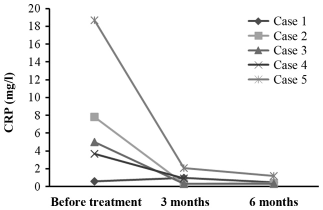 圖4：每位患者治療前后的CRP水平。1名患者的CRP水平降低，而其他4名患者的CRP水平保持穩定并在正常范圍內。