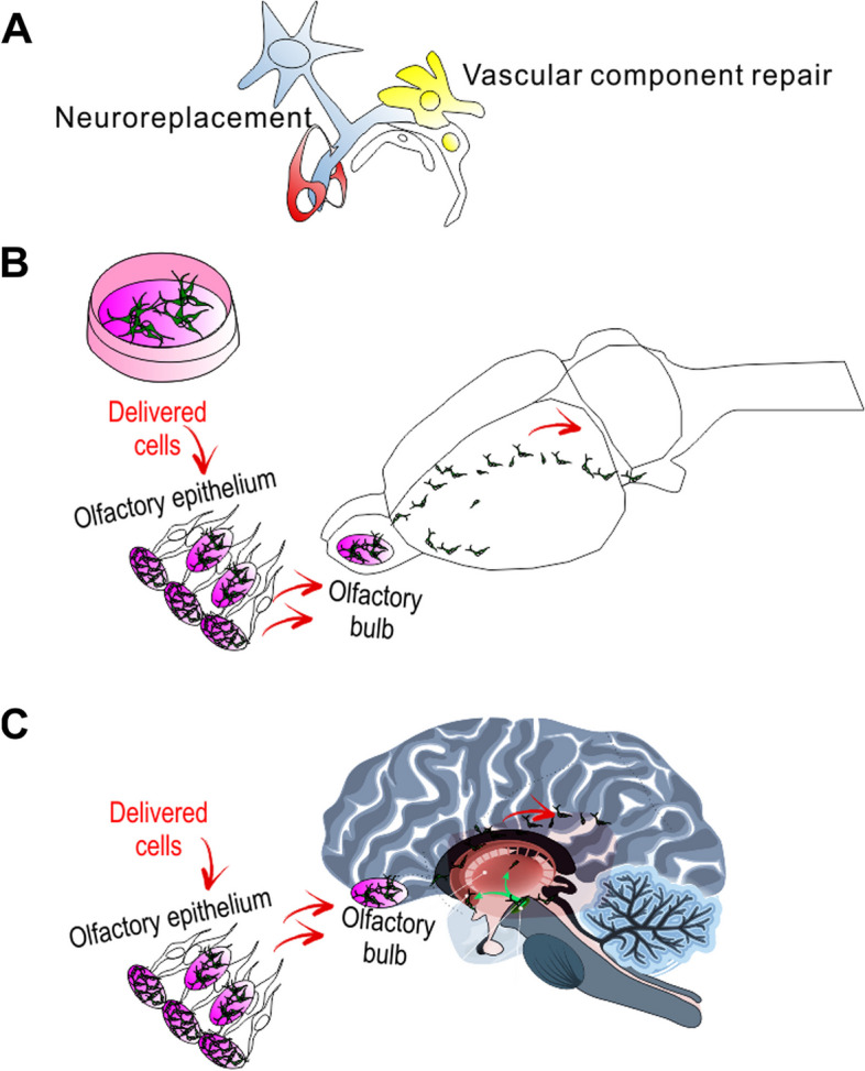 圖1：干細胞移植治療帕金森病的示意圖。