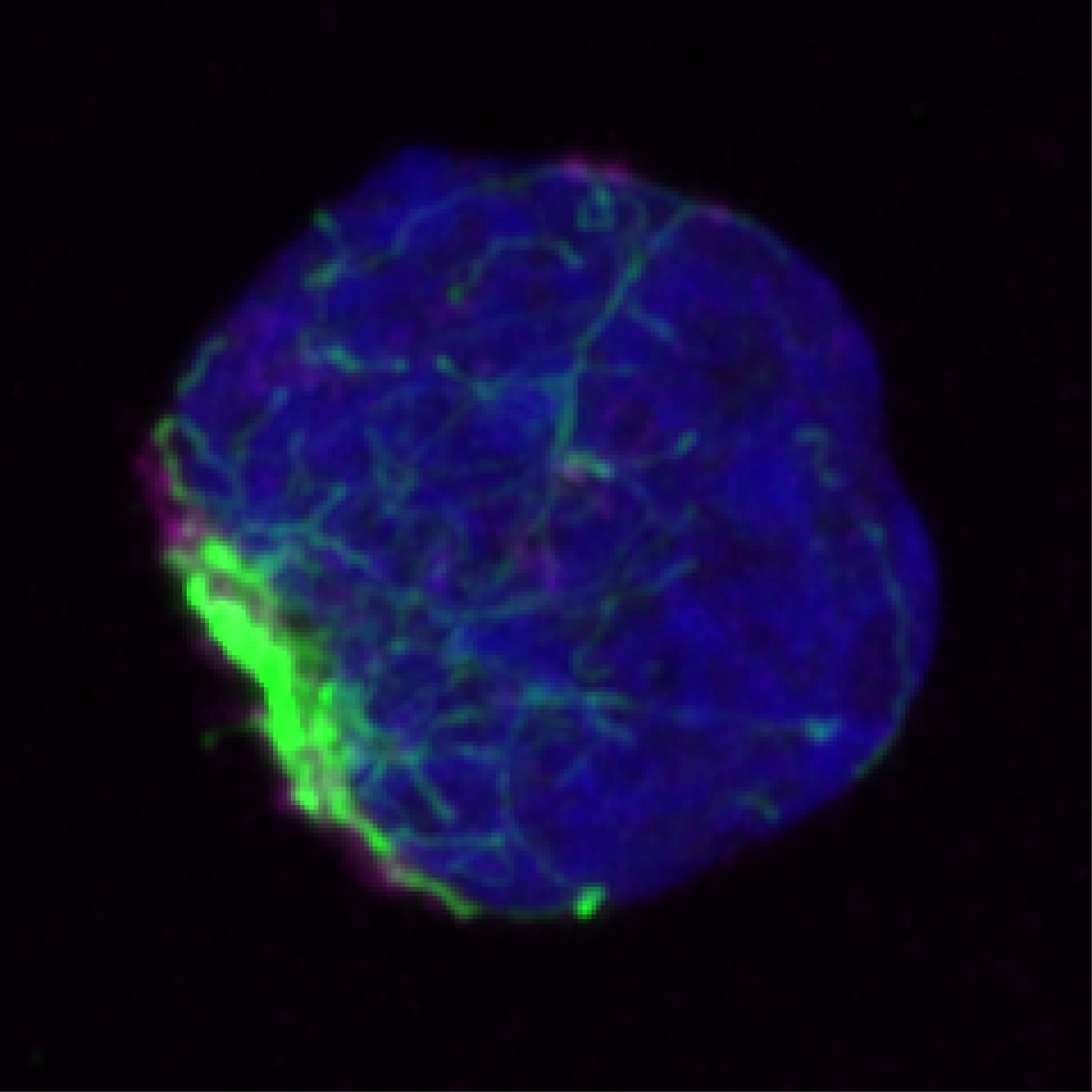 加州大學(xué)圣地亞哥分校的科學(xué)家發(fā)現，錯誤折疊的蛋白質(zhì)在被處理之前聚集并被限制在干細胞內的單個(gè)區域（綠色）中。