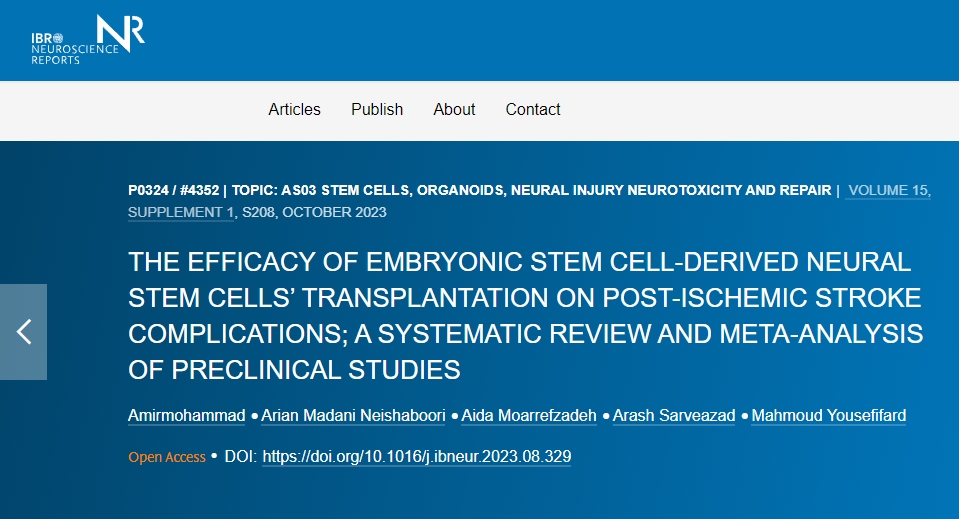 胚胎干細胞衍生的神經(jīng)干細胞移植對缺血性中風(fēng)后并發(fā)癥的功效如何？