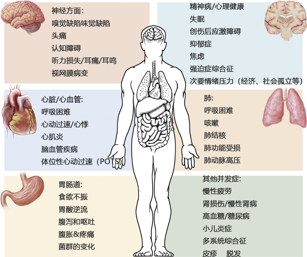 間充質(zhì)干細胞可改善多種新冠后遺癥