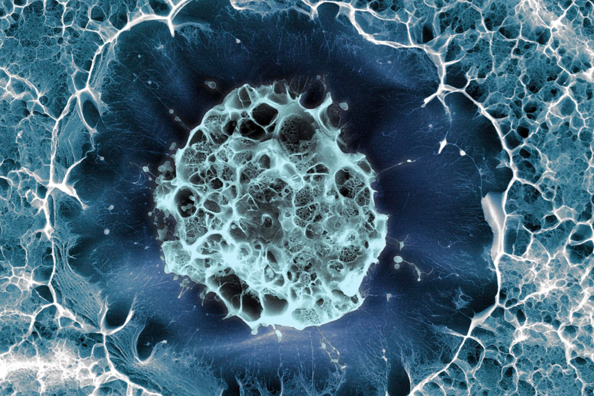 基于人類(lèi)干細胞的帕金森病療法被證明是安全的