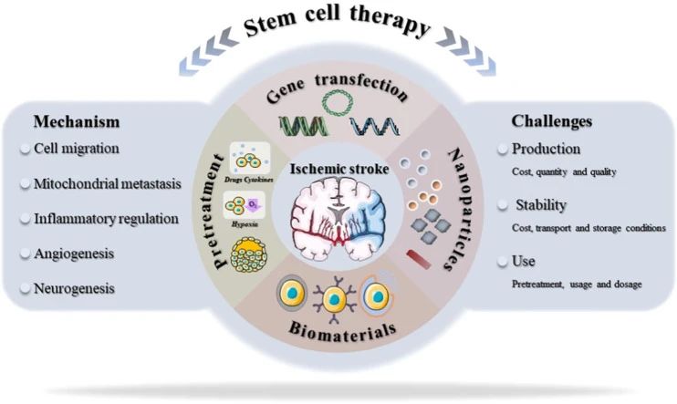 干細胞治療中風(fēng)新進(jìn)展：一項206人的隨機臨床試驗結果揭曉啦！