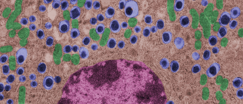 利用間充質(zhì)干細胞治療1型糖尿病的潛力如何？