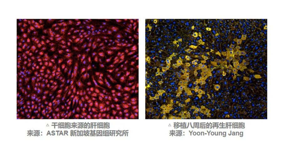 MSC有望通過(guò)不同途徑調動(dòng)肝臟細胞再生來(lái)改善預后。