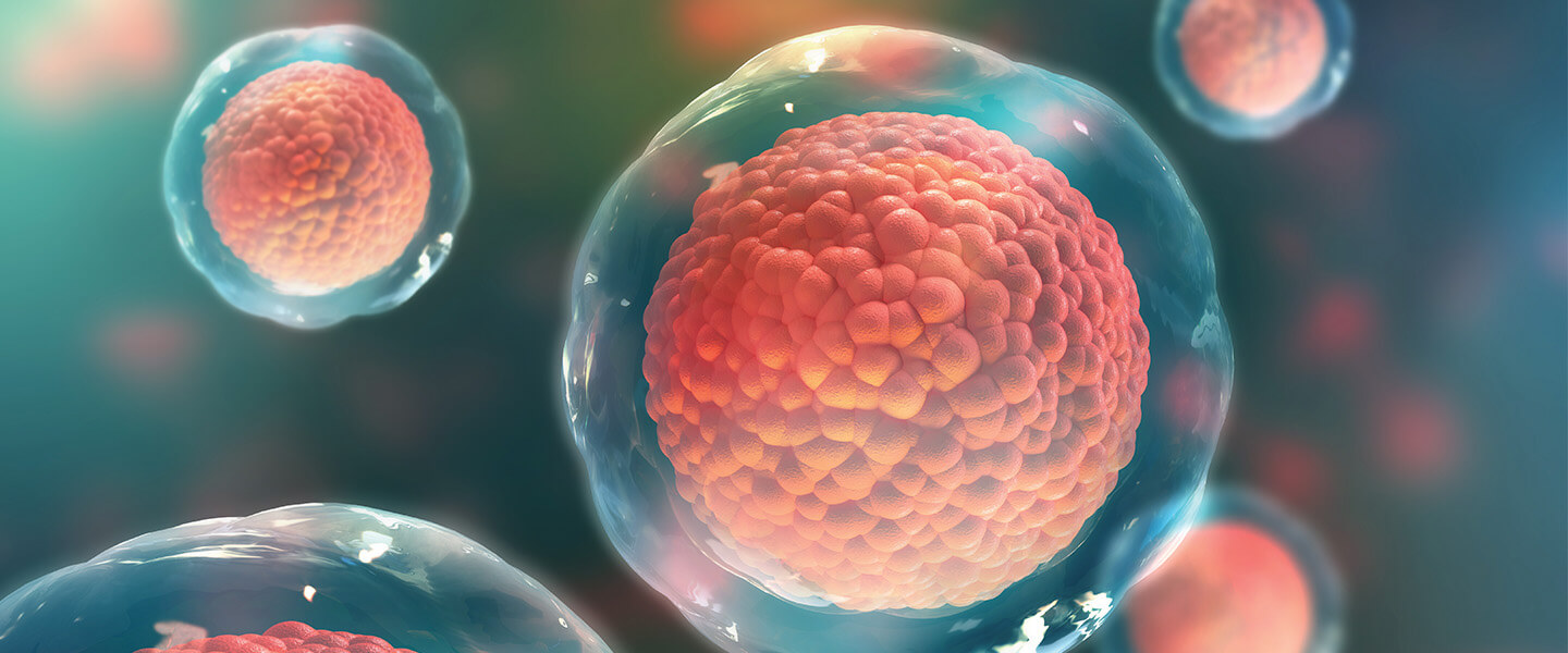 干細胞技術(shù)有助于確定精神分裂癥的潛在因果機制