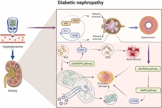 圖1：糖尿病腎病的病理信號。