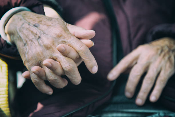 拜爾旗下子公司針對帕金森病的I期臨床試驗在18個(gè)月時(shí)繼續顯示積極趨勢