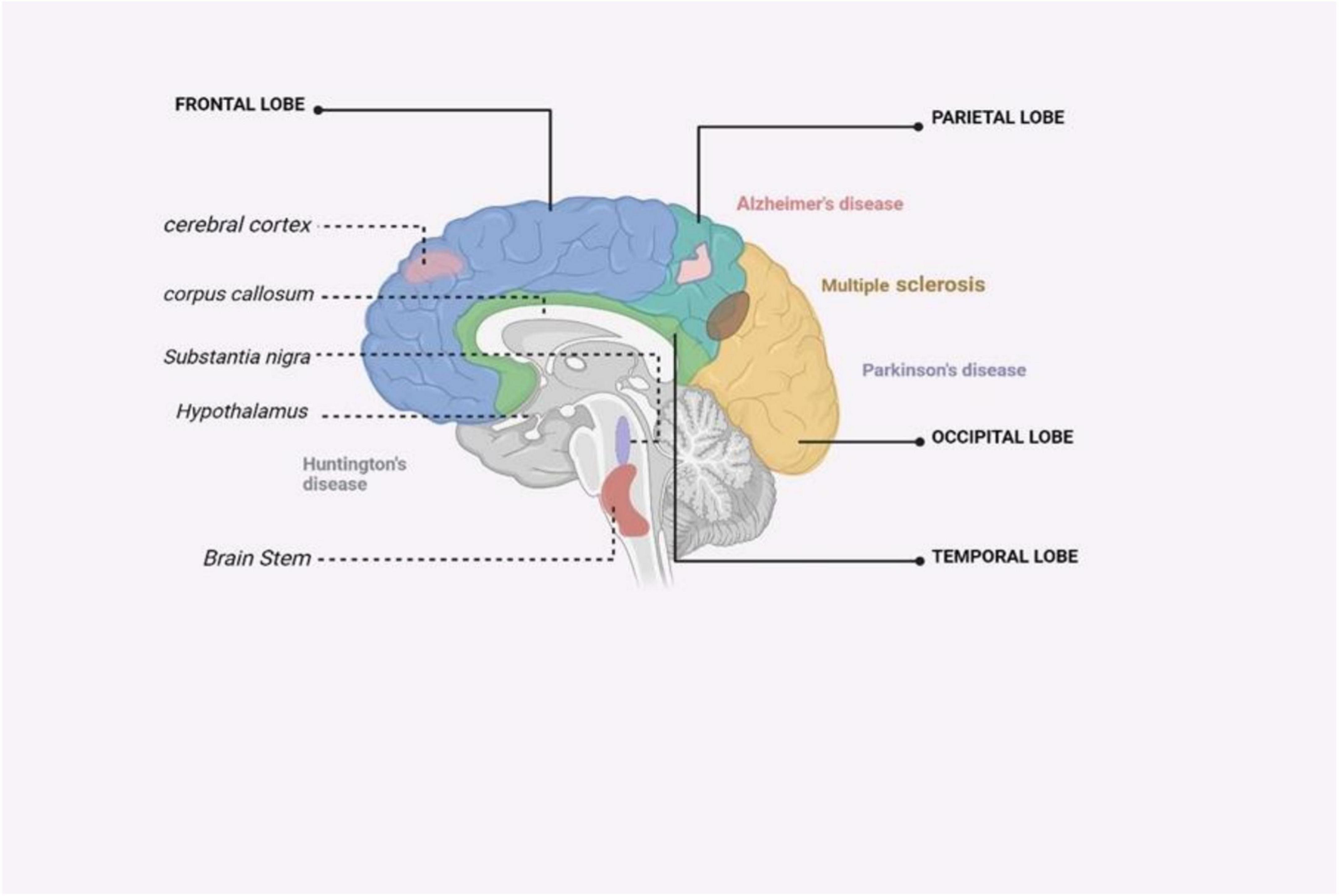 圖4：受主要神經(jīng)退行性疾病影響的大腦區域的圖解摘要