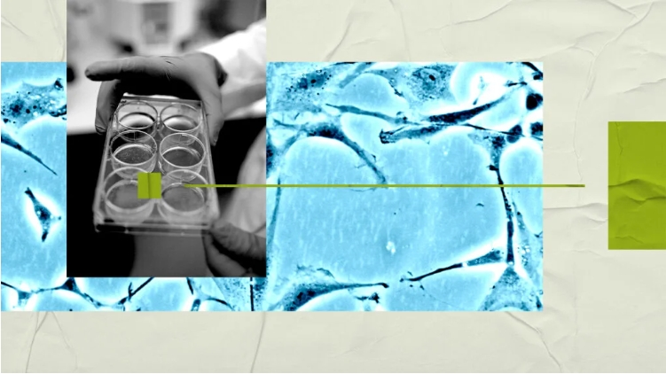 研究人員稱(chēng)，大腦研究可能有助于開(kāi)發(fā)新的精神分裂癥治療方法。