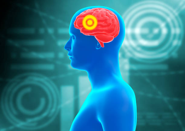 中風(fēng)患者的康復策略有哪些？