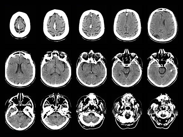 老年神經(jīng)系統會(huì )出現哪些問(wèn)題？